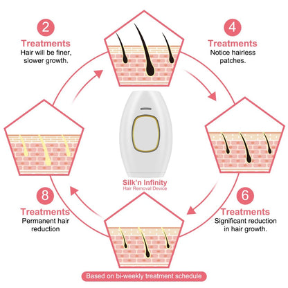 IPL Hair Removal (Women)
